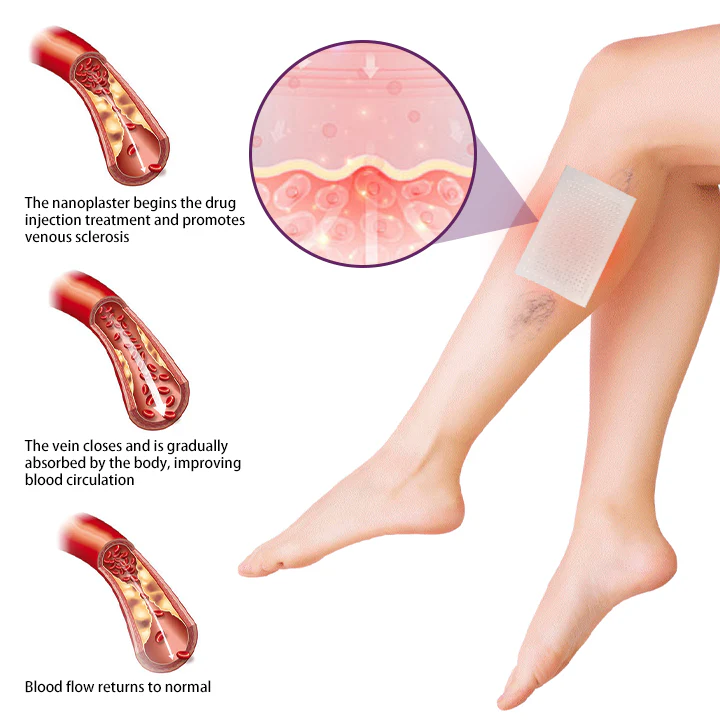 IMAIBMAI Nano-Tech Vein Patch – Flawless Leg Renewal 🦵